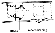 venous abnormalities diagram