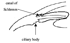 Angle Closure Glaucoma diagram