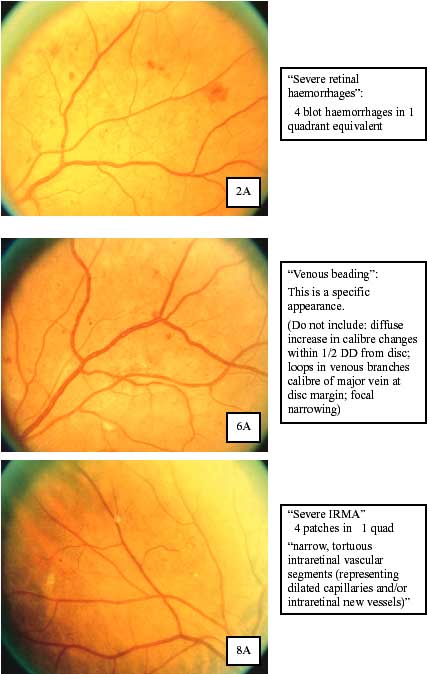Referable Retinopathy photos
