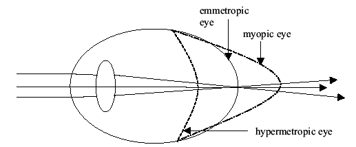 VISUAL ACUITY diagram