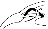 Angle Closure Glaucoma diagram