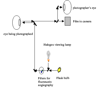 Mydriatic Camera diagram