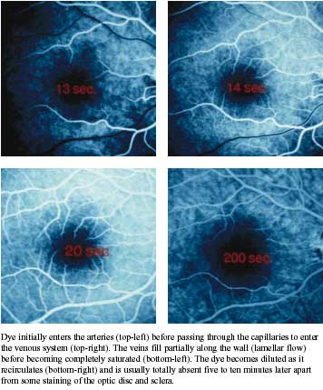 FLUORESCEIN ANGIOGRAPHY photos