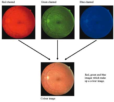 IMAGE ACQUISITION photos
