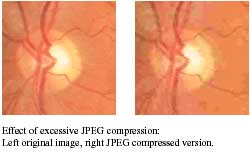 Lossy Compression photo