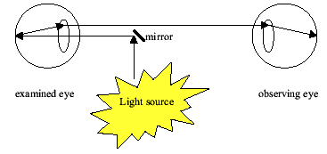 DIRECT OPHTHALMOSCOPY diagram